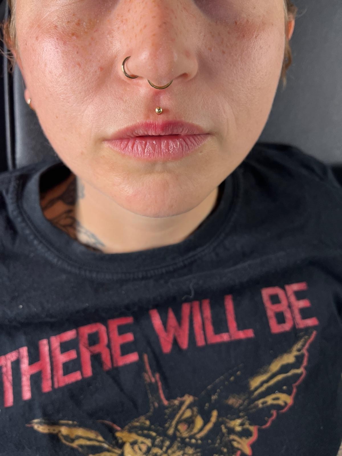 Lippen-Piercing Ergebnis